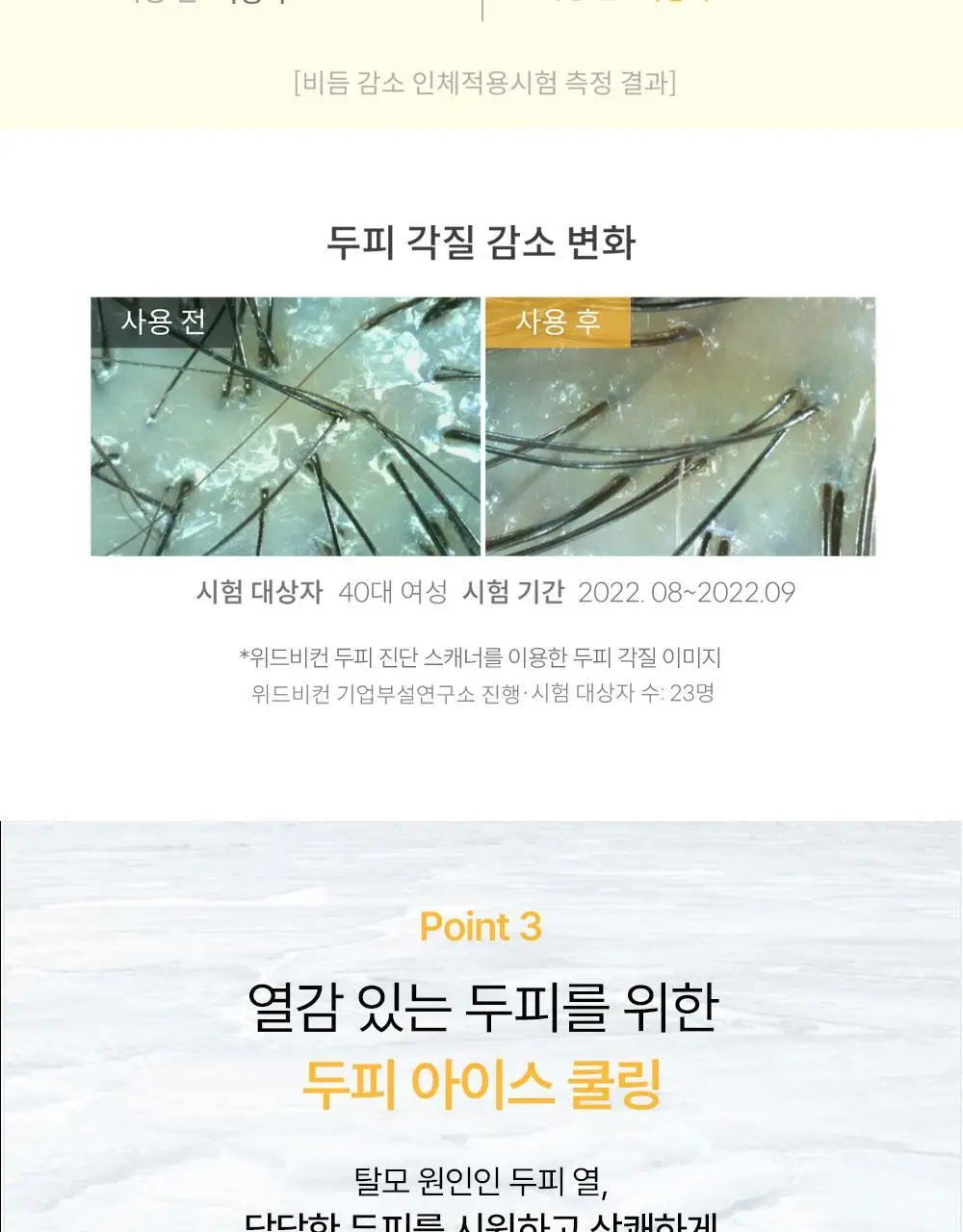 [맞춤형 탈모샴푸] 위드비컨 두피 코렉팅 샴푸 360ml(두피별 샴푸) 상세페이지 28